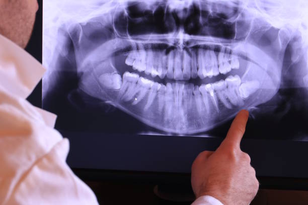 Best Emergency Denture Repair in Montverde, FL