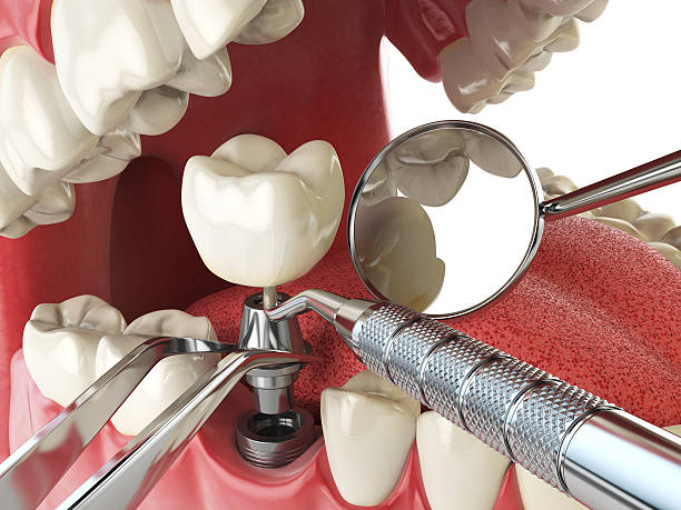 Best Emergency Cosmetic Dentistry (e.g., broken veneers) in Montverde, FL